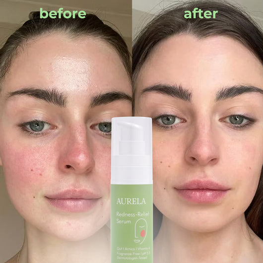 Redness Reform Soothing Serum