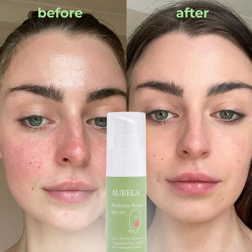 Redness Reform Soothing Serum